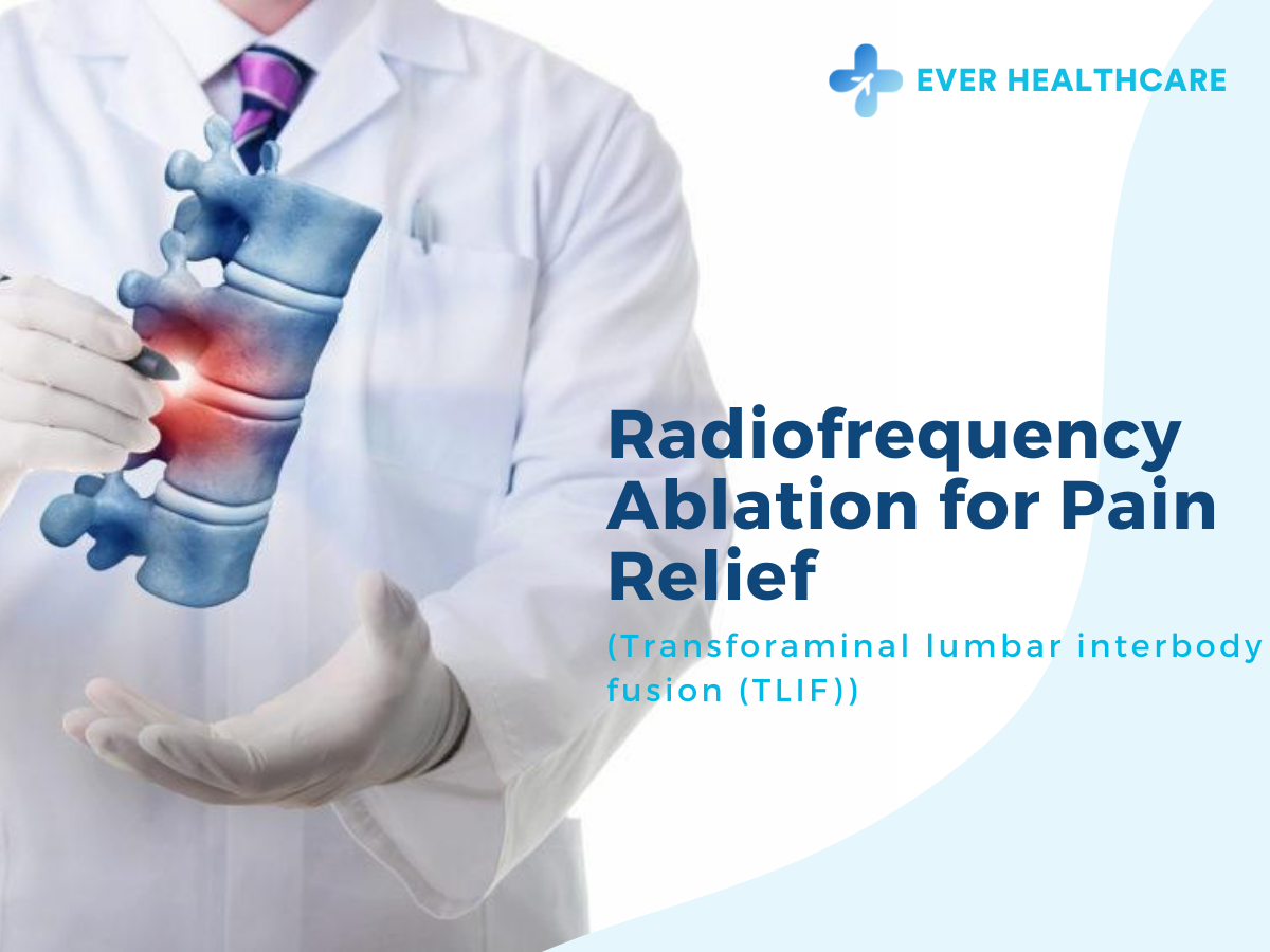 Radiofrequency Ablation for Pain Relief in Thailand 2023 Compare Price